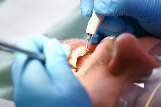 Best Mobile Emergency Dentist in Moose Wilson Road, WY